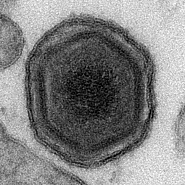 African_swine_fever_virus_virion_TEM.jpg