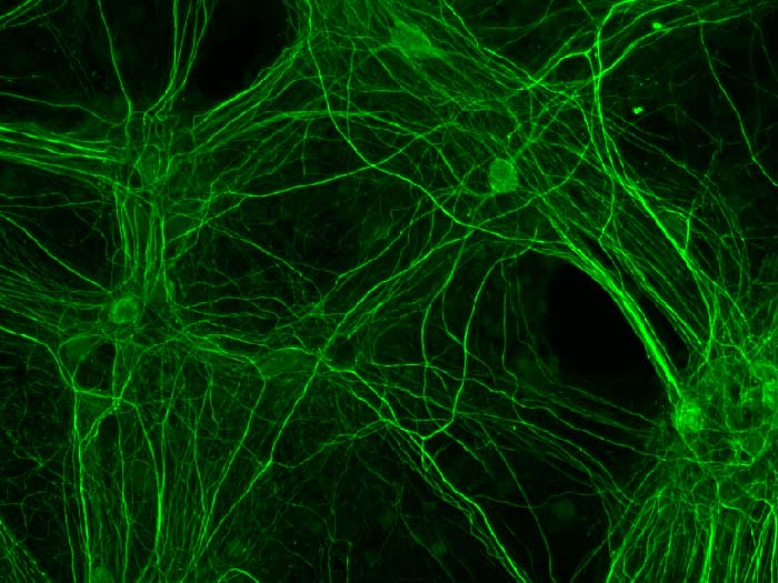 cluster of stained neuron cells