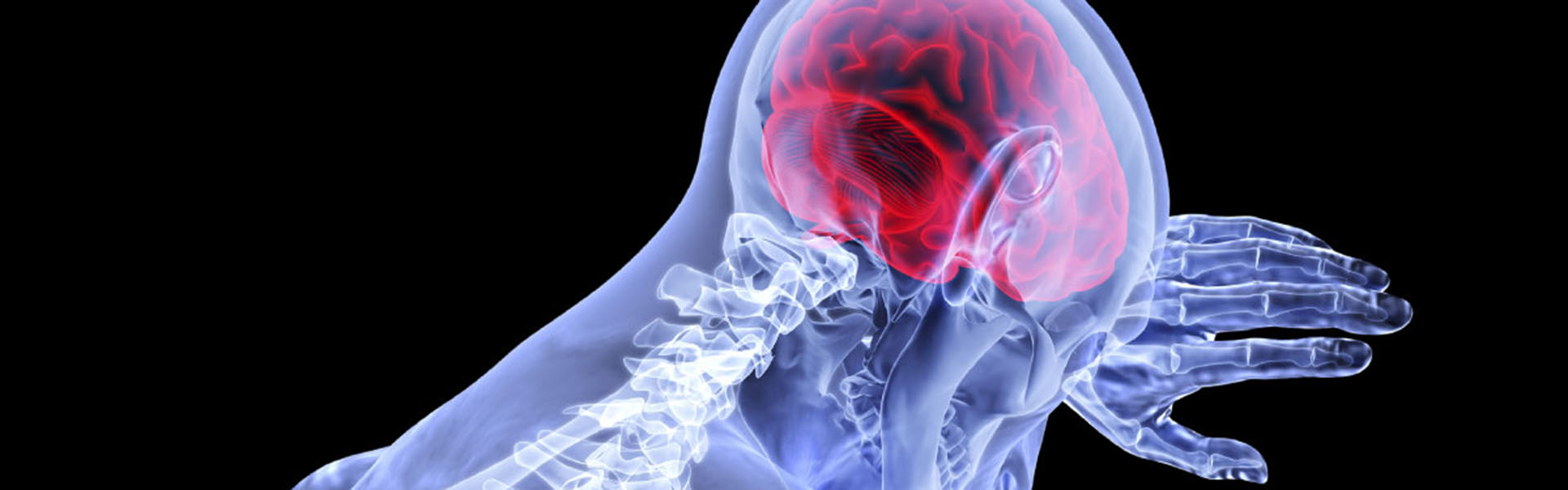 computer illustration of a traumatic brain injury